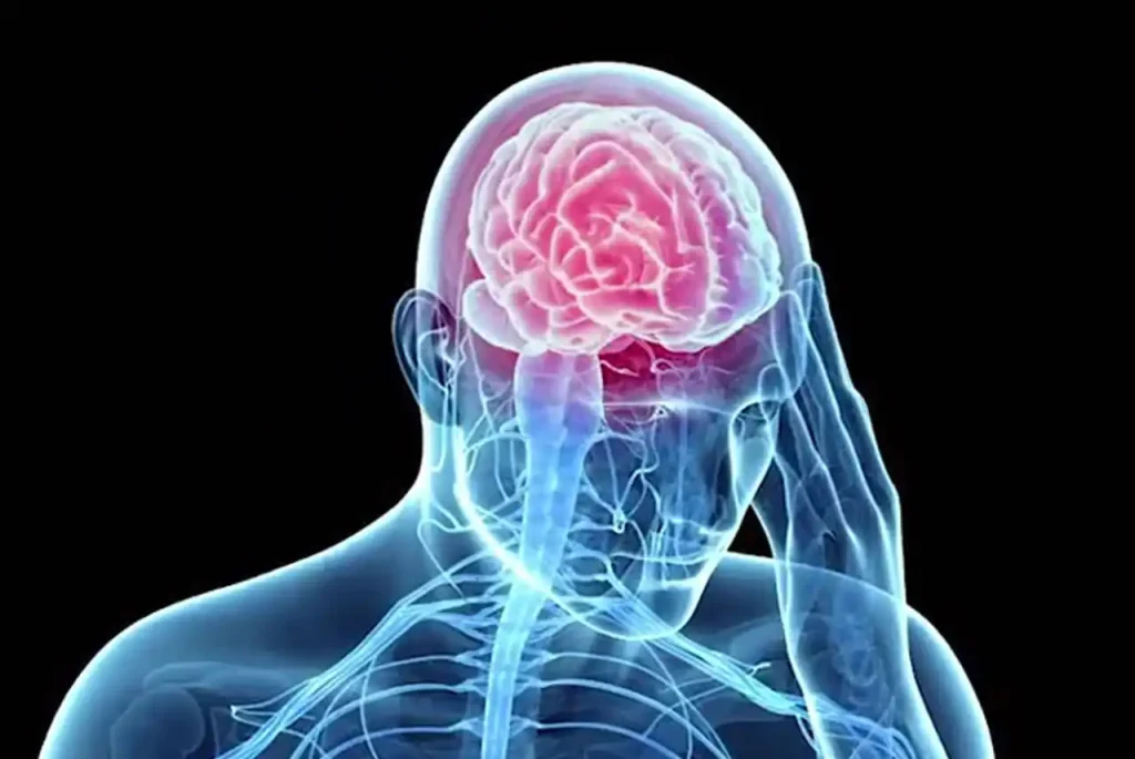 Florida Brain Injury Attorney​